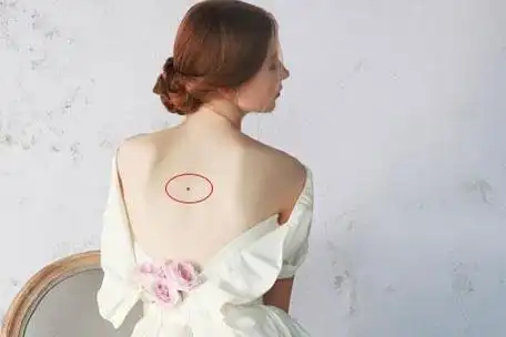 女人巨富痣和大富痣长在哪里