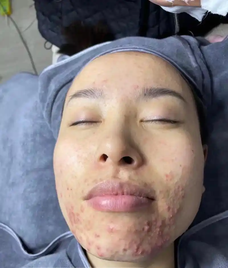 面部皮肤护理 #专业的事交给专业的人 一款多功能中药面膜招 - 抖音