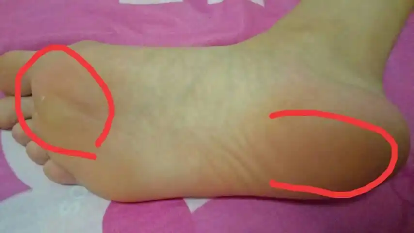 眼(右侧);2.耳(右侧)3.斜方肌(颈肩部);4.肺,支气管.