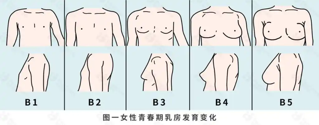 从儿童期到成年期按照女孩乳房发育性成熟分级(tanner分期法) 可分为5