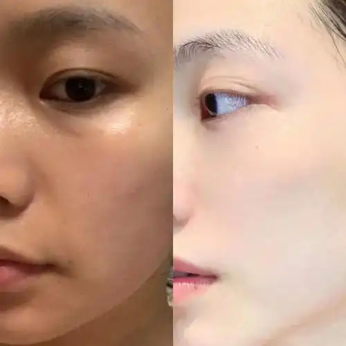 皮肤天生黑的女生还能变白吗 - 知乎