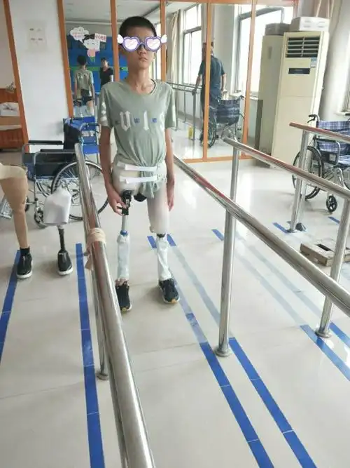 请问双大腿截肢患者的假肢原配原则是什么?(康复治疗)