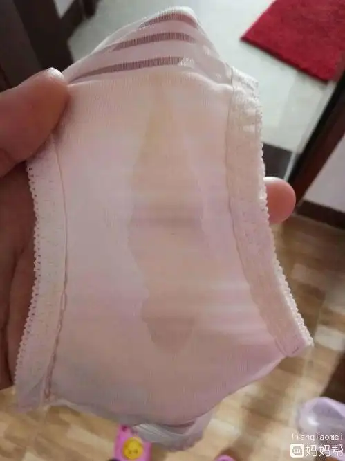 白带常规检查结果明确诊断,看是霉菌性阴道炎,细菌性阴道炎,滴虫性