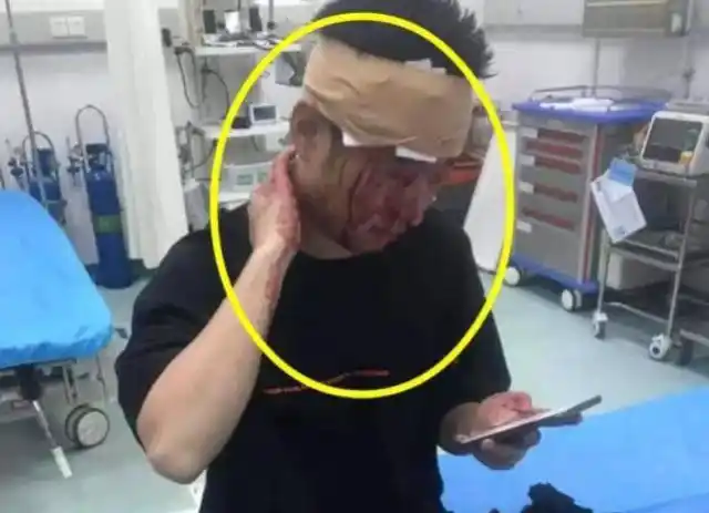 斗鱼主播钱小佳因劝酒不喝被当场砸头,满脸血上医院治疗!