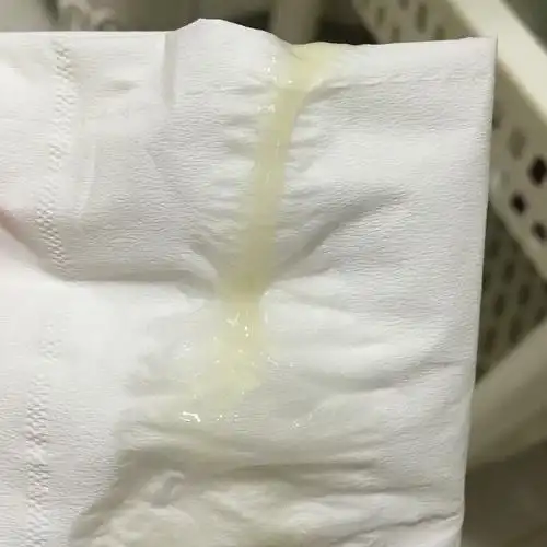 这样的白带是不是还有炎症?