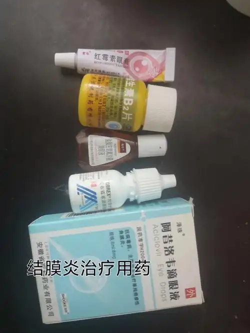 抵抗力可能下降初步怀疑是结膜炎,买了托百士滴眼液和红霉素眼膏3