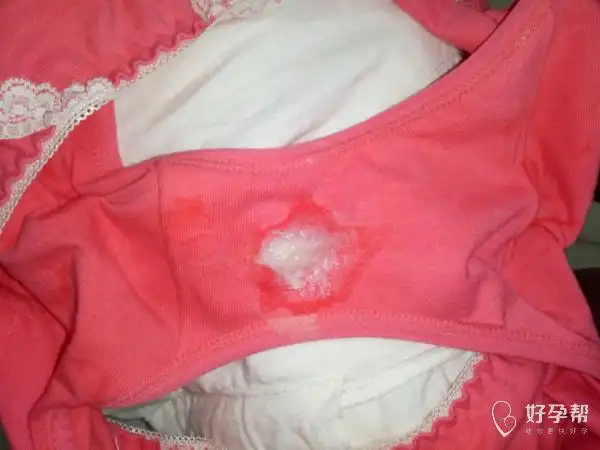 大家看看我的白带 我是不是有妇科病