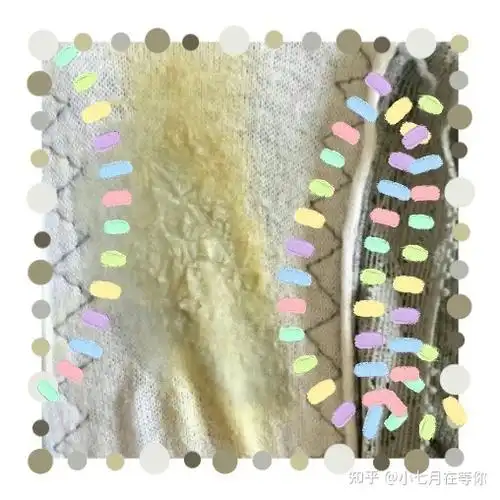 如何自检妇科炎症通过白带可以看出