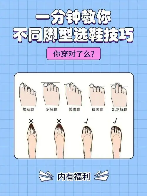 脚型测试最后一种脚型夏天穿凉鞋很好看