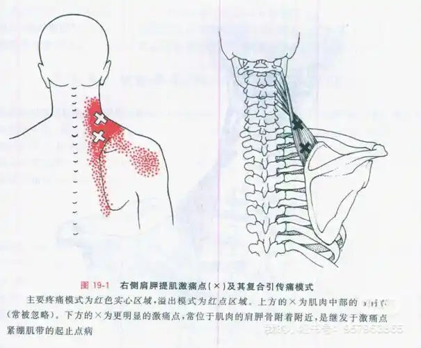 30肩胛提肌的肌筋膜处理思路