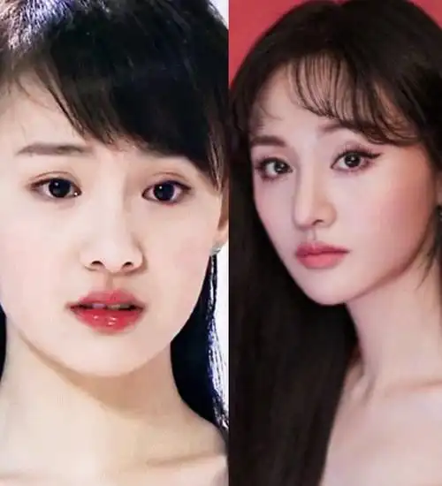 郑爽经纪人正面喊话腾讯故意抹黑,到底是为了热度还是_圈子-新氧美容