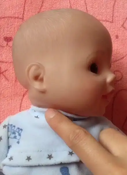 宝宝为什么会歪脖子?