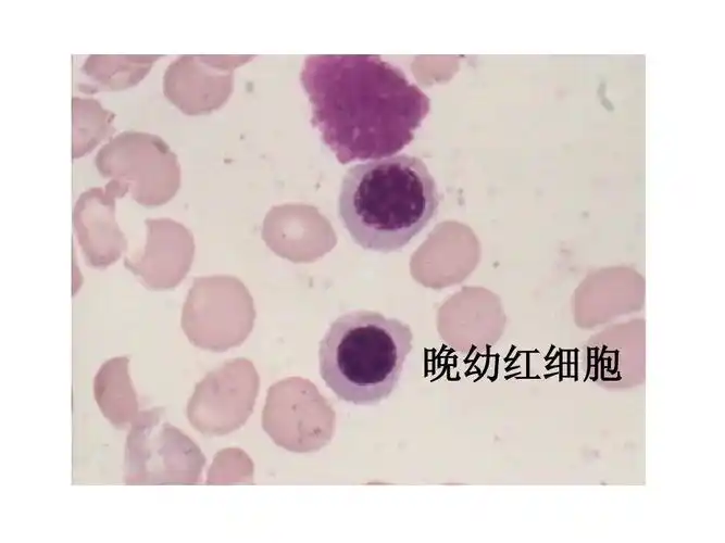 实验诊断学 晚幼红细胞