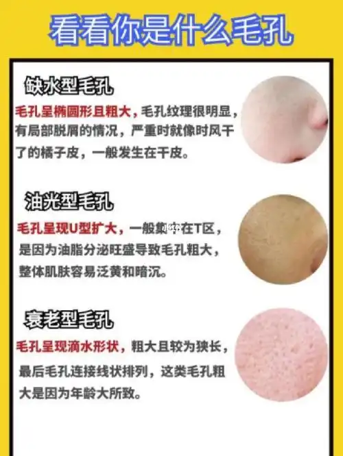 用了它毛孔粗大终于改善了