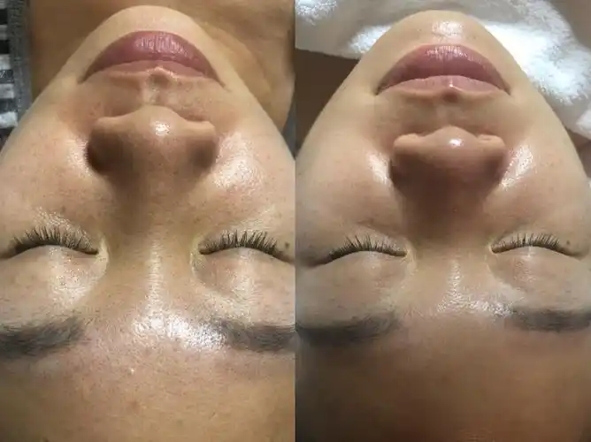 圣妆国际&法国圣路易斯皮肤管理海口站2018年9月13-15日