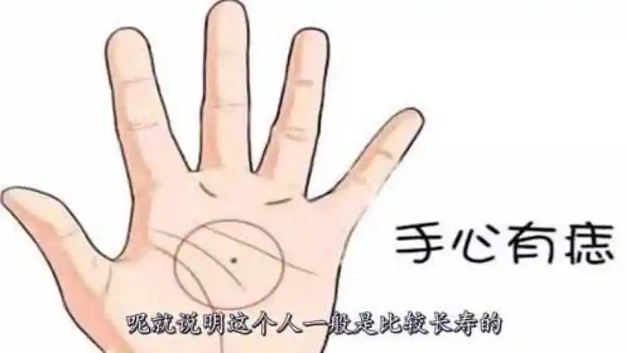 身上这几处有痣的赶紧看看长在手上的代表什么呢