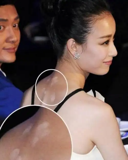 明星们最想删除的照片,张张照片辣眼睛,丑态百出尴尬至极!