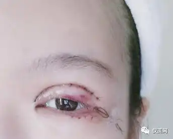 知识有着独到的见解,结合个人特点以及相关理论知识运用到手术中去