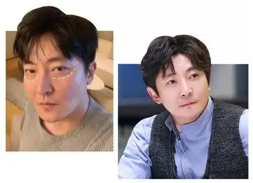 郭京飞割完眼袋后形象骤变!黑西装造型太有范,对比早前判若两人