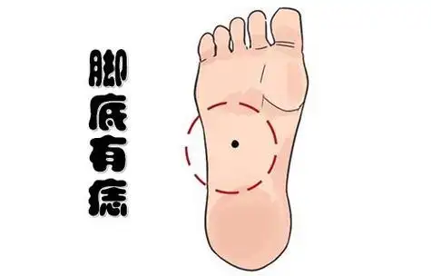 痣相一:脚底有痣"脚踏一星,能管千兵;脚踏七星,皇帝之命"在相学中