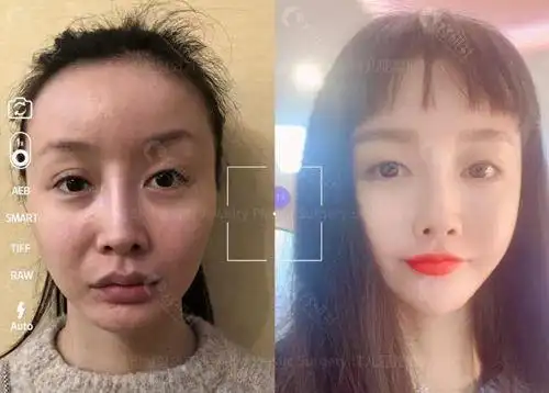 韩国小姐姐360度上镜脸秘籍:竟是因为珠儿丽童颜抗衰提升术 - 爱美容