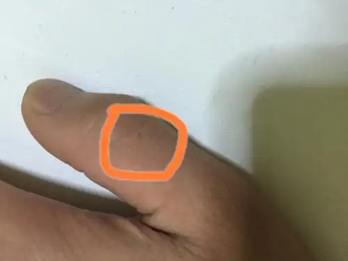 左手拇指长了颗痣,还有让大神帮我看看手相