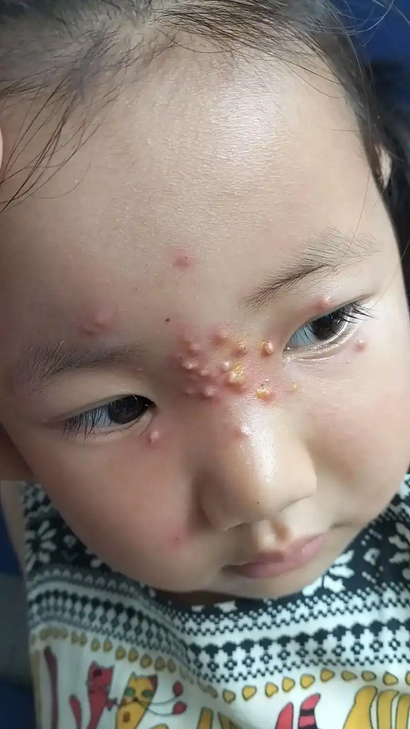 玩着玩着不小心自己又碰破,破了血都流的脸上吓死人!走