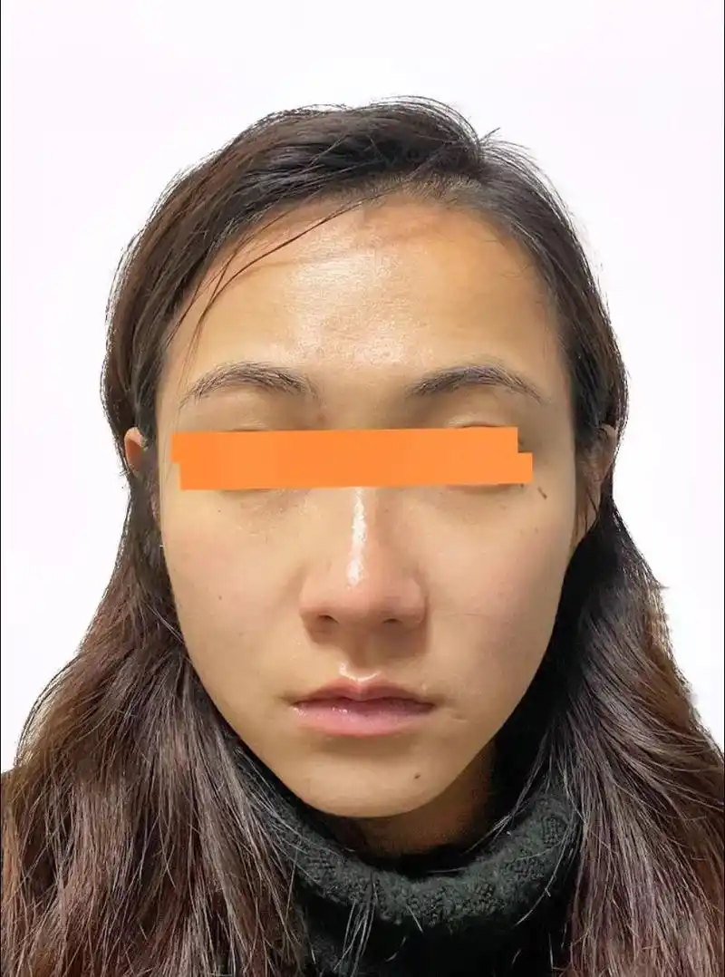 耳朵有点轮飞廓反,也就耳轮难包裹耳廓,这类人个性十足,特别在 - 抖音