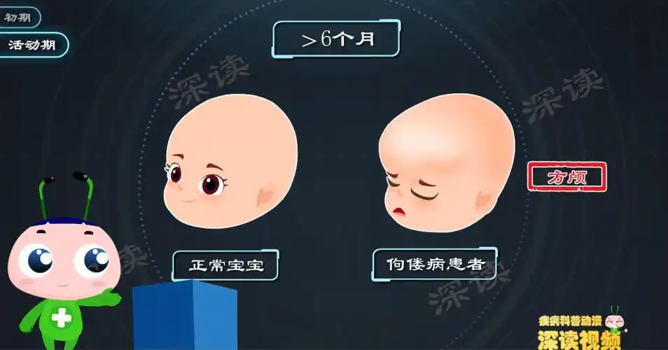 6个月后宝宝出现头围增大,头颅外观呈方形等情况,医学上称之为"方颅".