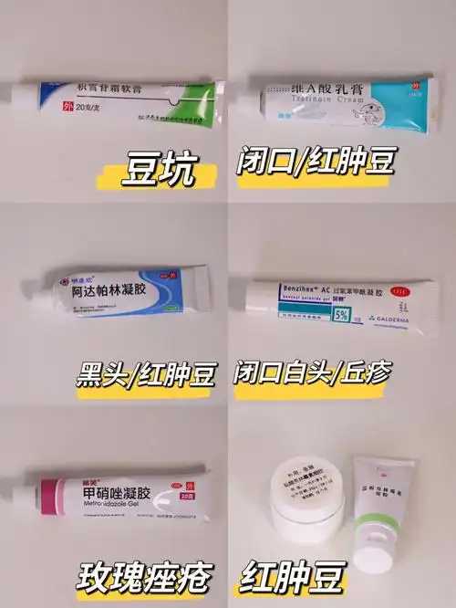 去痘印药膏用法