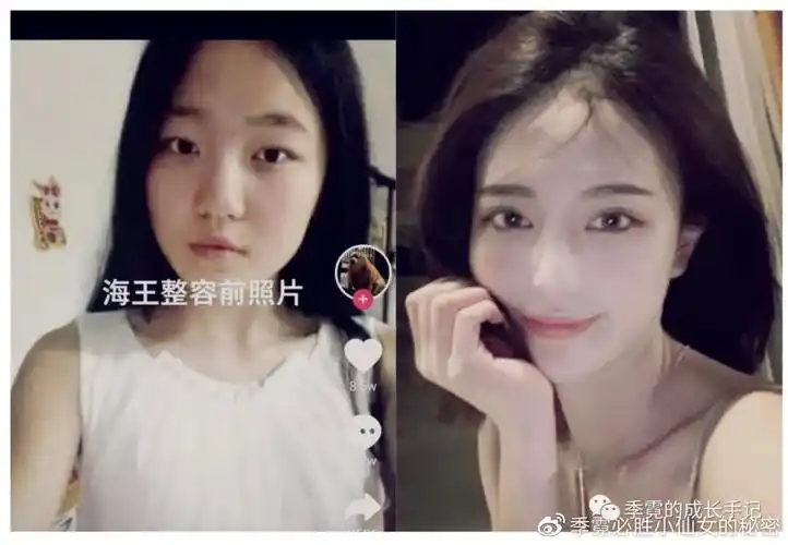 大家不要一提到整容就嗤之以鼻,在现在大小网红几乎没人不整的情况下
