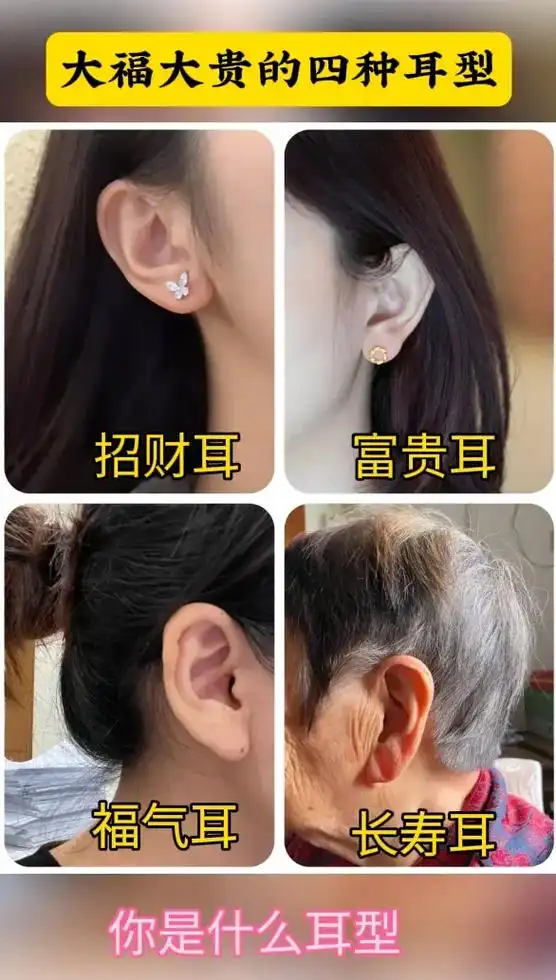 你是什么耳型 #耳朵大有福 #神奇的耳朵 #测耳型 #五官 - 抖音