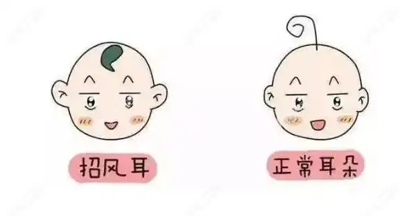 宝宝8种常见畸形耳朵图片大全,不同种类耳畸形矫正方法不同 - 整形