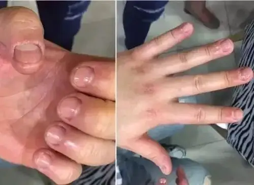 啃指甲吃手咬铅笔孩子小动作背后暗藏心理问题要警惕