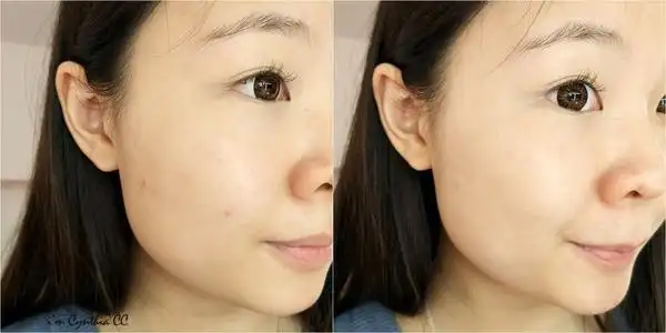 控油是不是去油的意思 怎样面部控油最有效