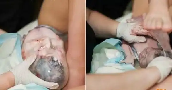 小宝贝被裹在了胎膜之中.帮助母亲生产的是女儿.