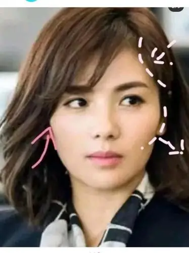 刘涛的整容式逆生长