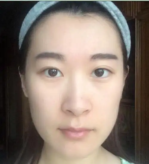 山根有横纹是否象征着财运的低迷?