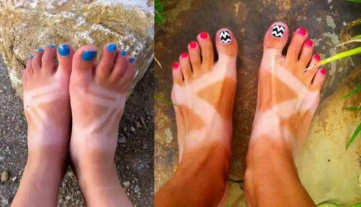 英国迎来100年来最热夏天,热衷晒日光浴的人变成啥样了?