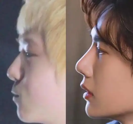 王阳在同样角度下的面部状况,才发现面部自然的人呈现出来的脸是什么