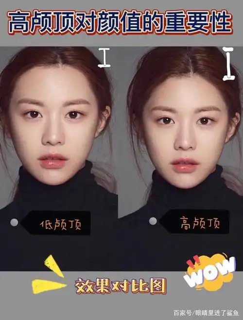 高颅顶到底有多重要?