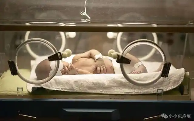 早产儿住5个月保温箱花了100万!箱子里到底有啥特别?