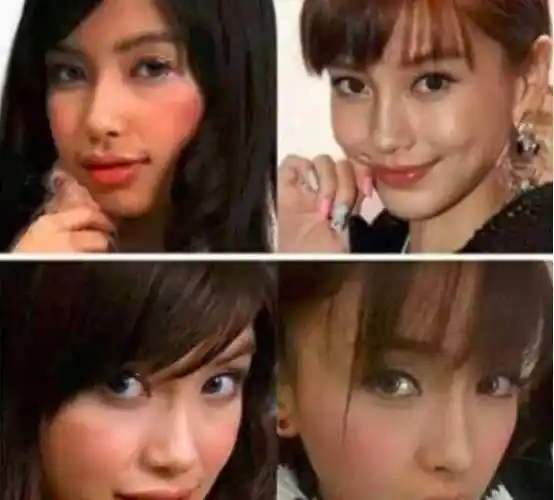 angelababy变脸前旧照流出,笑起来嘴歪脸严重畸形,有