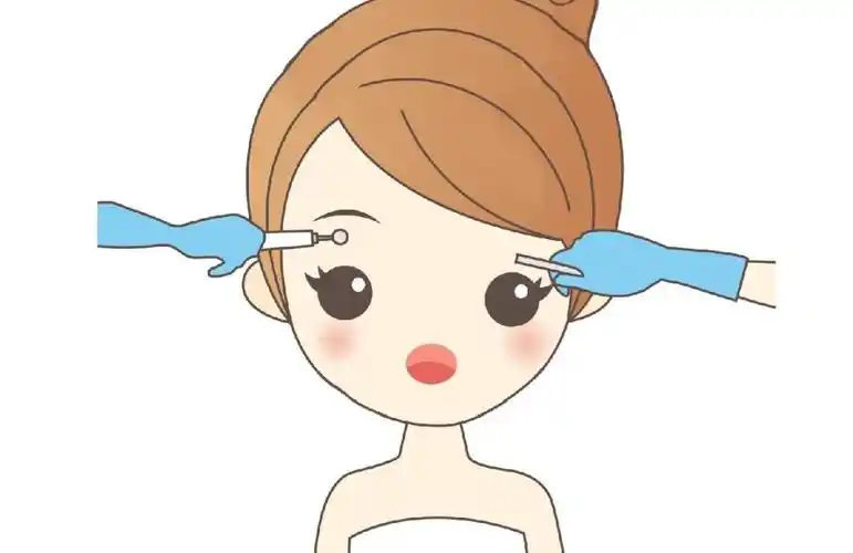 眉毛种植效果为何那么理想