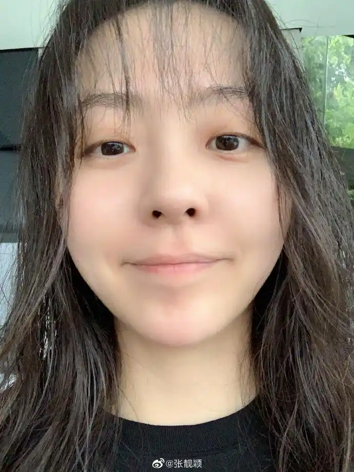 张靓颖咬到自己撒娇求安慰 晒素颜照自侃红颜薄皮超逗趣