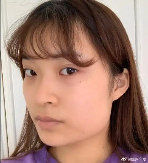 都是蛮不错的,从业二十年往上,都是做颌面项目,下颌角,颧骨内推之类的