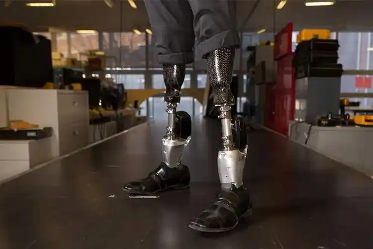 双腿截肢后他成为仿生宗师研制假肢和真的一样