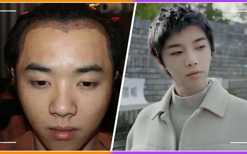 网曝疑似华晨宇植发视频,称张碧晨为小三,众人直呼信息量太大