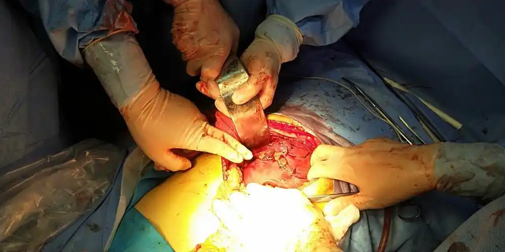 03.31高空坠落伤,外科楼上下联动,上演生死时速!