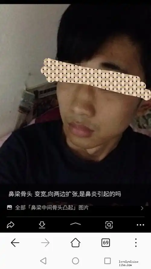 小朋友戴眼镜鼻梁骨两边凸起是怎么回事